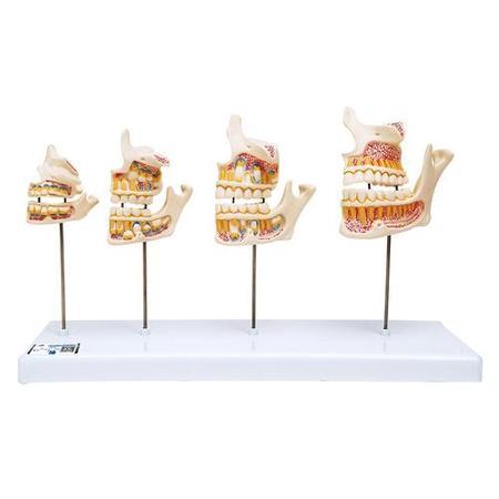 3B SCIENTIFIC Dentition Development - w/ 3B Smart Anatomy 1000248